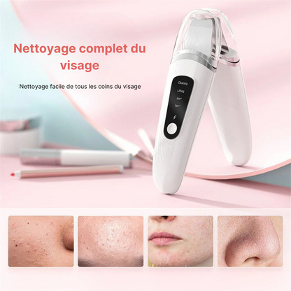 ÉpureSkin – Appareil Ultrasonique Visage | Nettoyage, Exfoliation & Lifting à Domicile